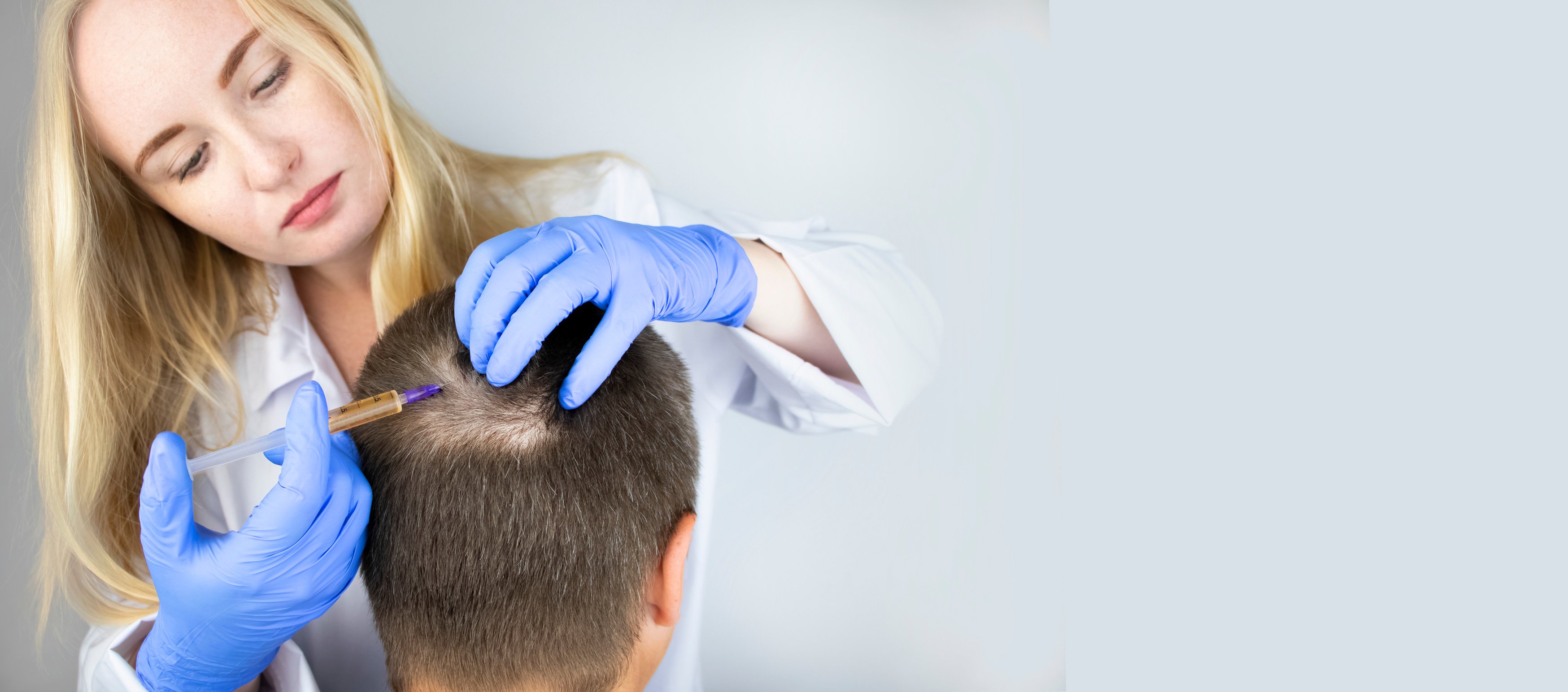 Trichologist Conducts Mesotherapy for Patient with Alopecia